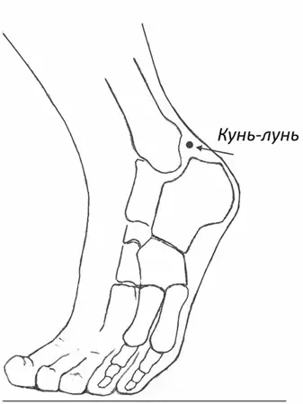 2 ШУГУ 65VII V65 на наружной стороне стопы позади головки плюсневой - фото 3