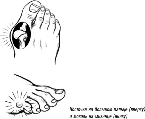 Во времена моего детства люди иногда обращались с этой проблемой к целителям - фото 5