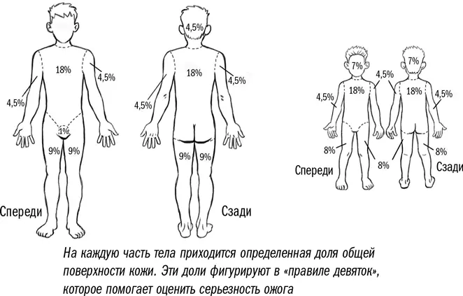 Возможно вы слышали старый бабушкин совет намазать место ожога жиром маслом - фото 12