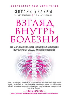 Энтони Уильям - Взгляд внутрь болезни. Все секреты хронических и таинственных заболеваний и эффективные способы их полного исцеления