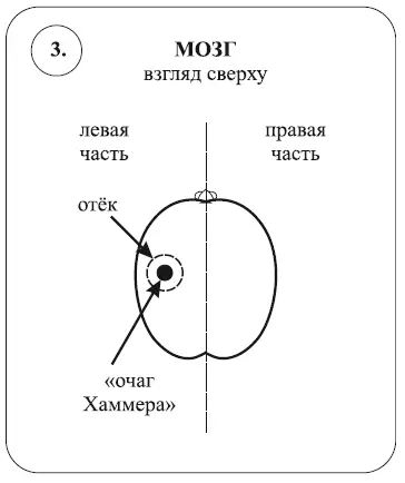Затем наступает момент когда процесс ремонта в мозге развился достаточно - фото 10