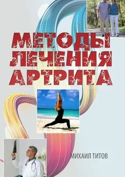 Михаил Титов - Методы лечения артрита