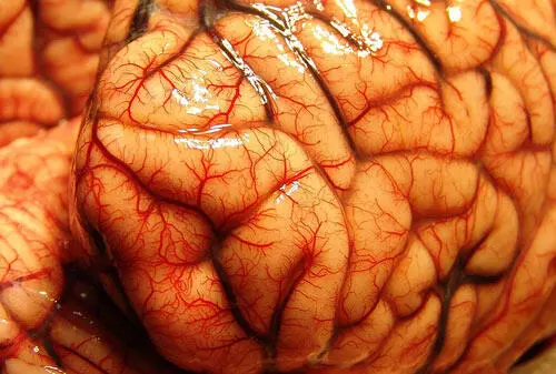 Мозг имеет два полушария Левое полушарие контролирует правую часть тела - фото 10