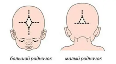 Череп конфигурируется под родовой канал кости черепа находят друг на друга - фото 1