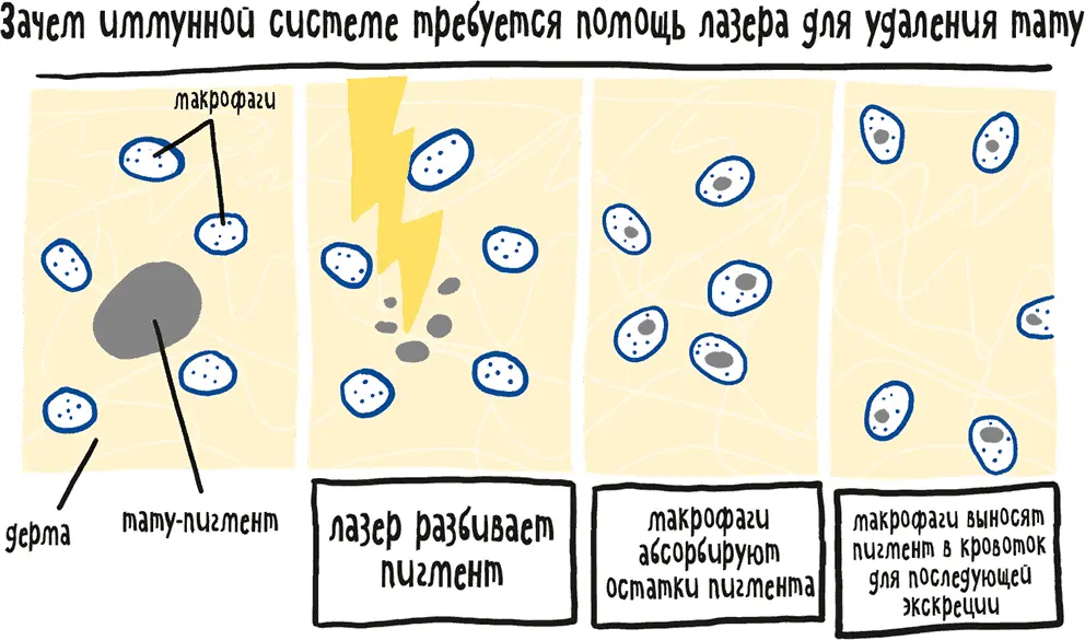 За последние десять лет индустрия по удалению татуировок в США выросла на 440 - фото 7