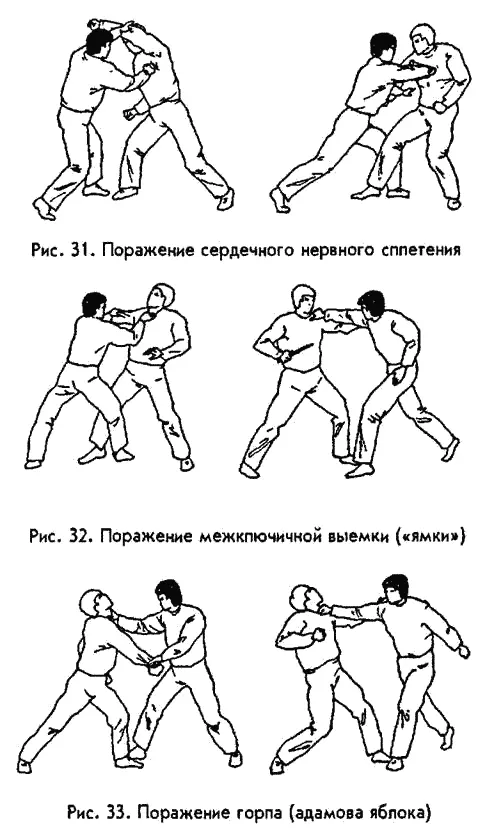 Даже легкое воздействие на расположенный в половых органах сосудистонервный - фото 30