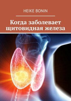 Диляра Лебедева - Загадочная щитовидка: что скрывает эта железа