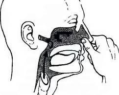 Продувка методом Вальсава доставить порцию воздуха в полость внутреннего уха - фото 15