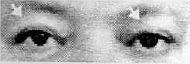 Глаза иудея располагаются существенно ближе к поверхности лица В спокойном - фото 110
