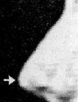 Носклюв тип носа с заострённым кончиком Ноздри вытянуты От еврейского - фото 46