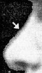 Небольшой по размеру нос с малым кончиком В профиль выглядит немного - фото 48