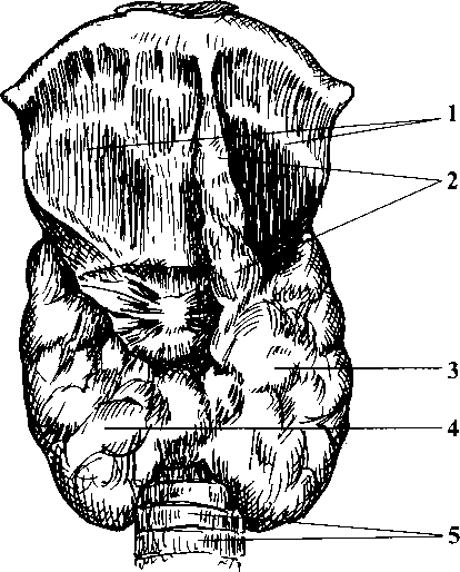 Рисунок 2 Щитовидная железа вид спереди 1 щитовидный хрящ 2 - фото 3
