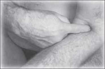 Рис 45 Боли в голеностопном суставеВозникают при длительном ношении - фото 45