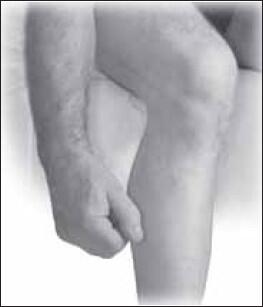 Рис 71 Заболевания коленных суставов С возрастом постепенно размягчается и - фото 69