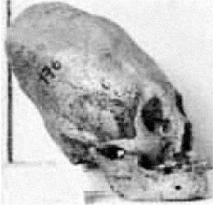 Эти черепа были сфотографированы Робертом Конноли Результаты своих - фото 62