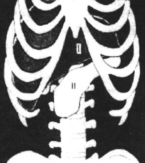 Схема расположения печени и поджелудочной железы Поджелудочную железу называют - фото 1