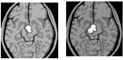 На левом снимке показан участок мозга активизирующийся у безумно влюбленного - фото 4