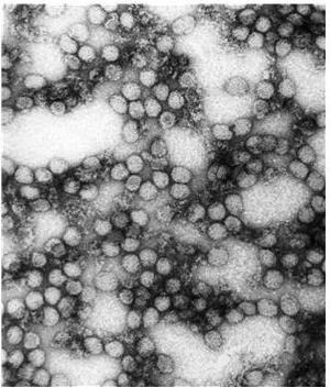Рис 1 Вирус желтой лихорадки ЭтиологияВирус ЖЛ был выделен в 1937 г в - фото 1