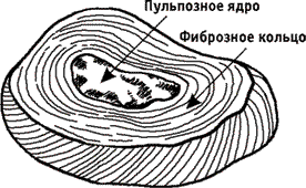 Рис 4 Межпозвонковый диск Диск состоит из пульпозного ядра напоминающего по - фото 4