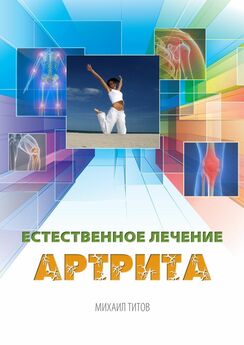 Михаил Титов - Естественное лечение артрита