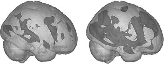 Сравните паттерны активации на этих двух изображениях Мозг на втором рисунке - фото 6
